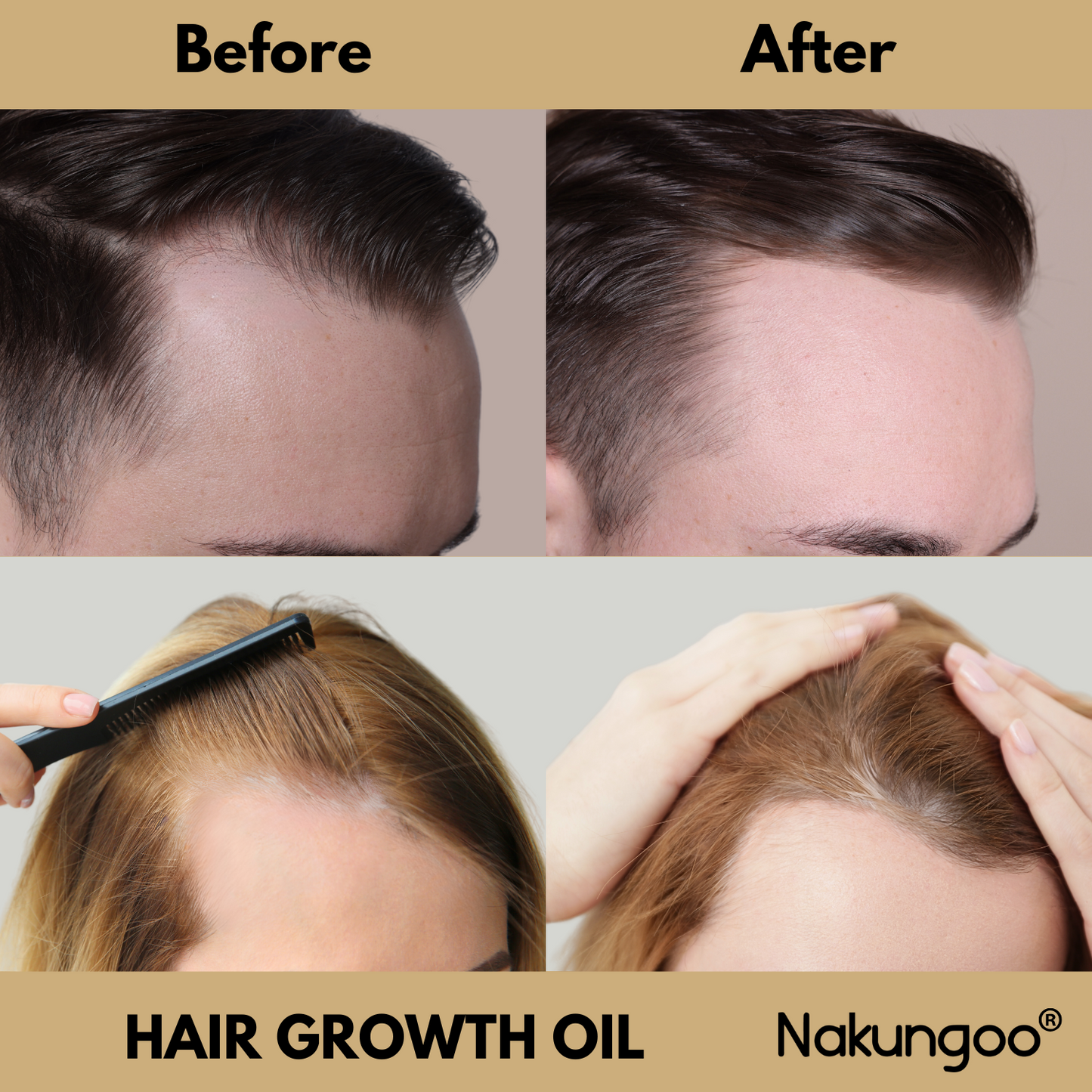 Hair Growth Oil